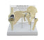 Model - Mini-Implant Joint Set