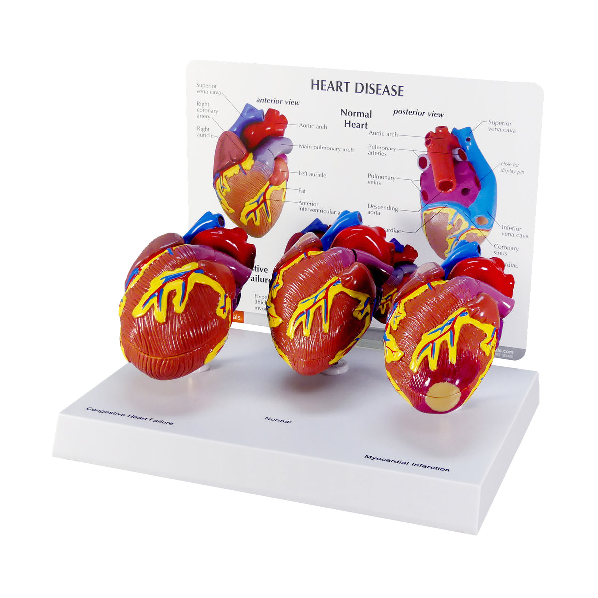 Basic Open Heart Set Model - 3-Piece Mini Heart Set