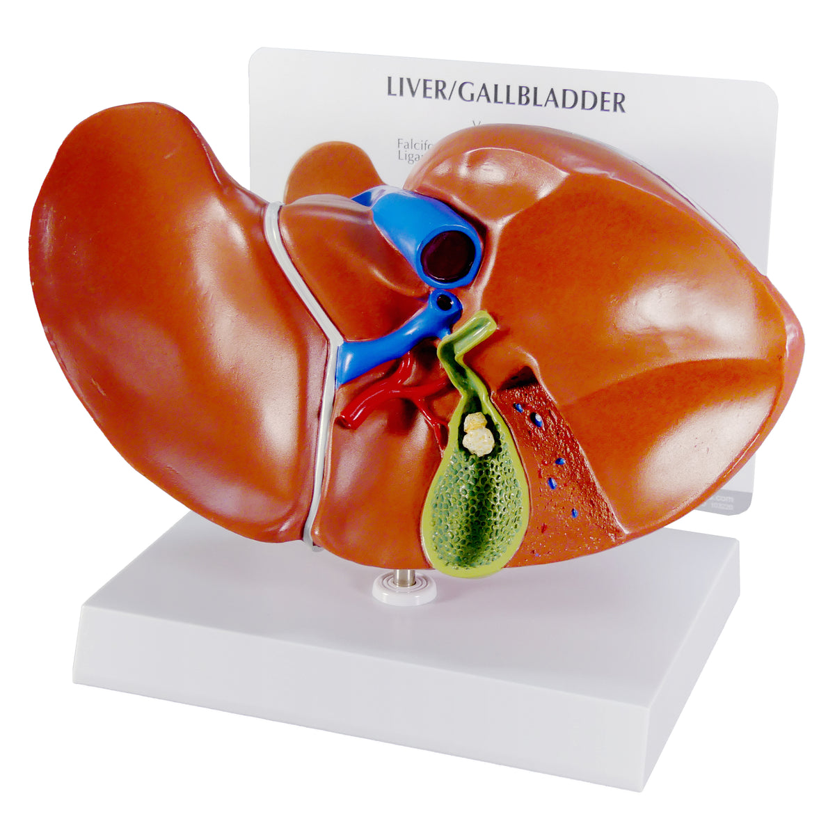Real Gallbladder Model Model - Liver/Gallbladder (with Gallstones)