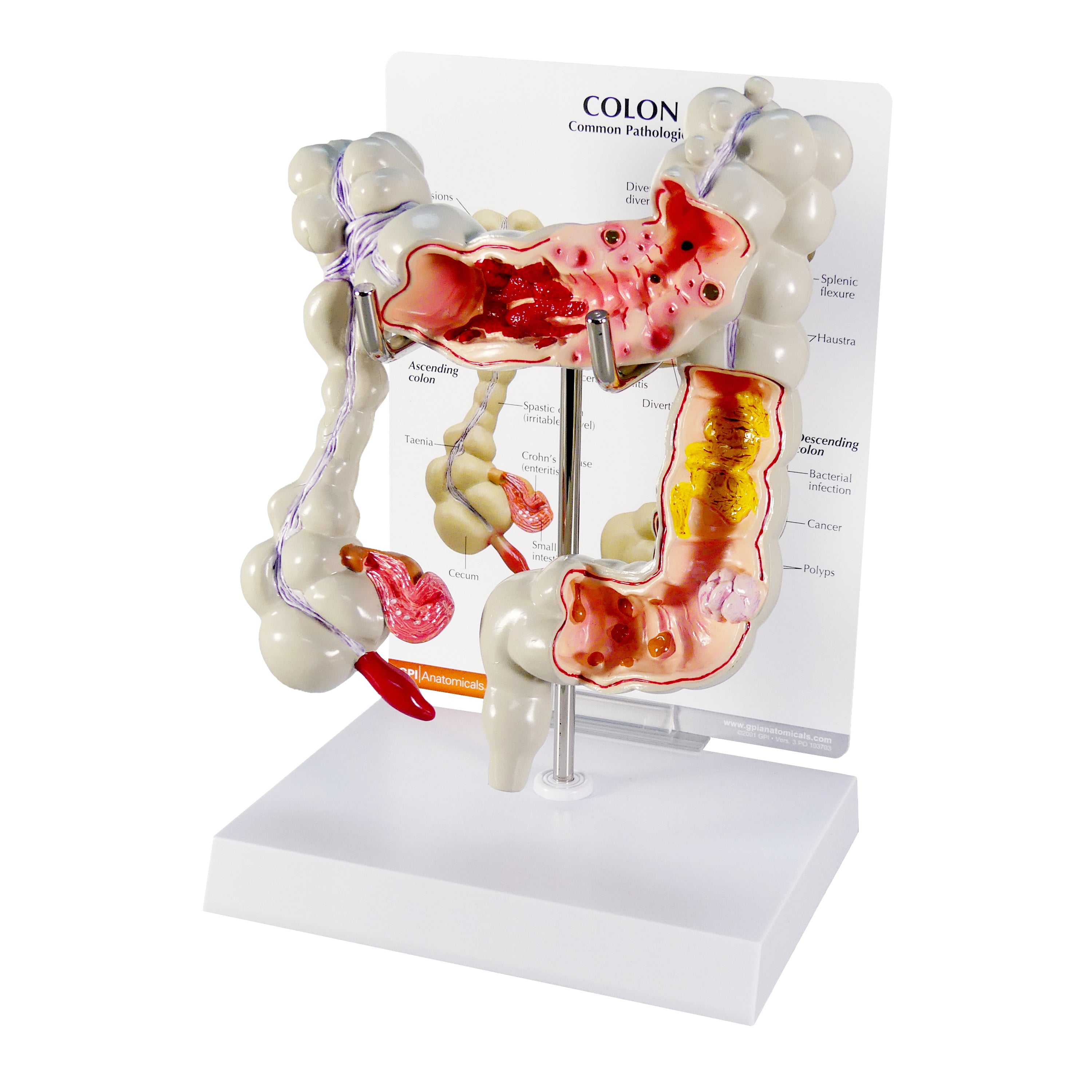 Model - Colon