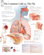 Chart - Common Cold vs. Flu