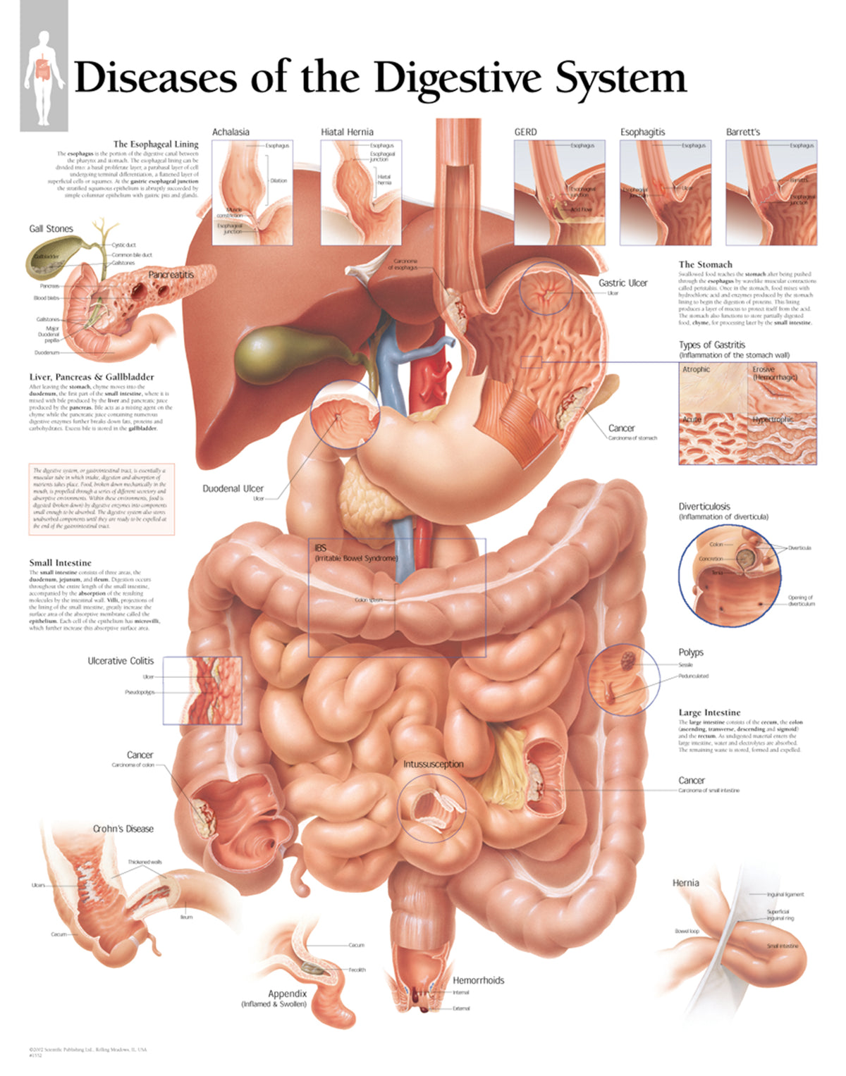 System Issue Digest Chart - Diseases of Digestive System
