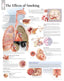 Chart - Effects of Smoking