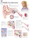Chart - Middle Ear Infection