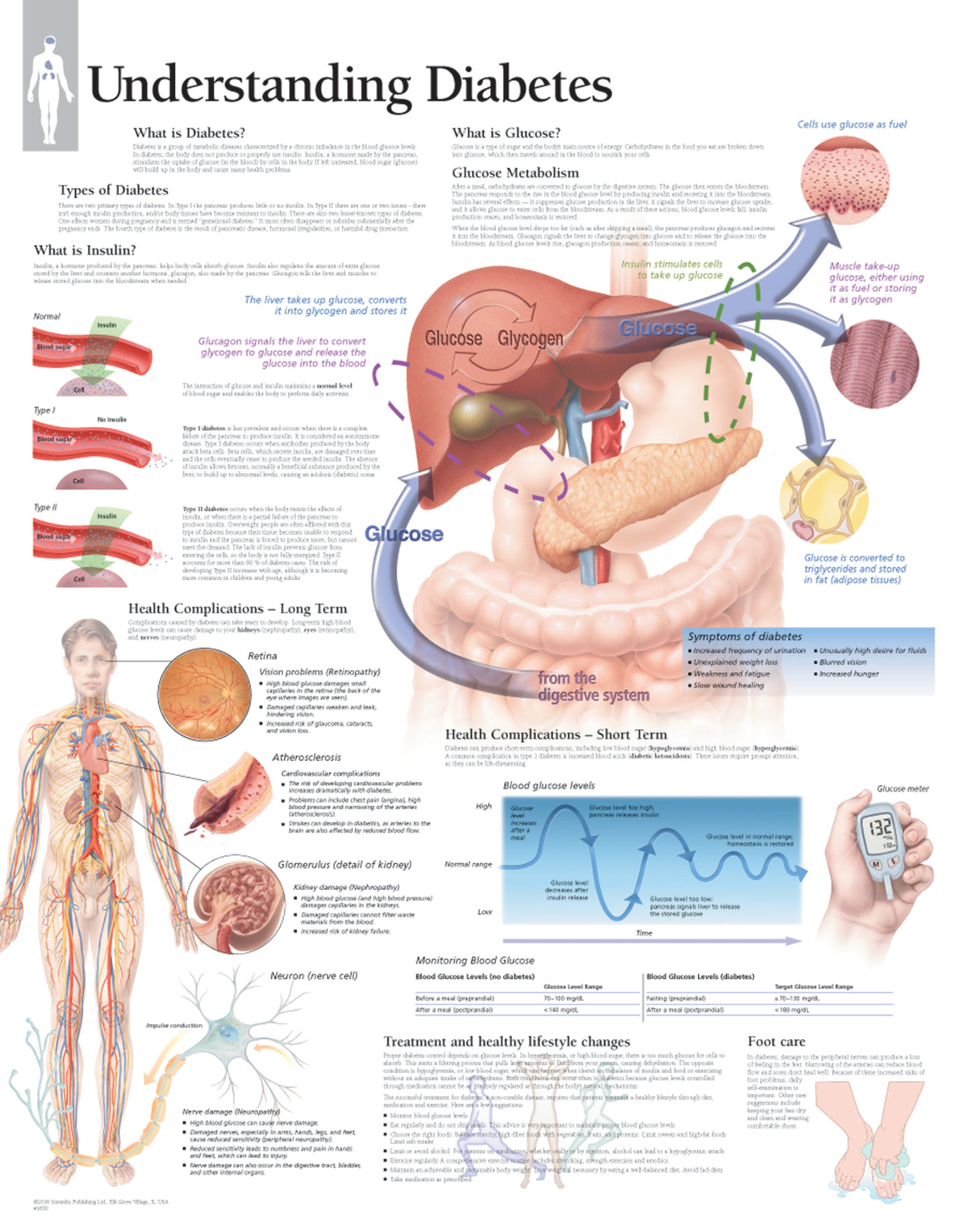 Chart - Understanding Diabetes