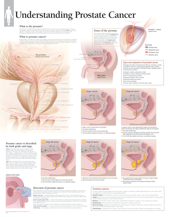 Protate Chart Chart - Understanding Prostate Cancer