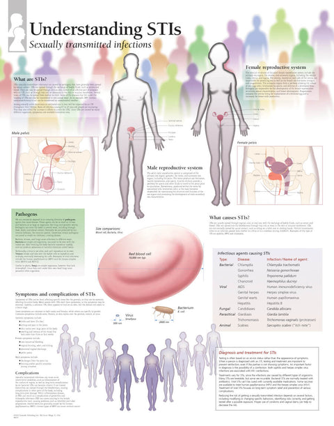 Chart - Understanding STIs