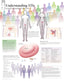 Chart - Understanding STIs