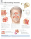 Chart - Understanding Sinusitis