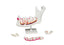 Lower Jaw Model