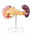 Pancreas, Duodenum, & Spleen