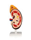 2 Part Kidney