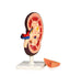 2 Part Kidney