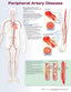 Reference Chart - Peripheral Artery Disease