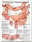 Reference Chart - Understanding Colorectal Cancer