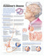 Reference Chart - Understanding Alzheimer's Disease